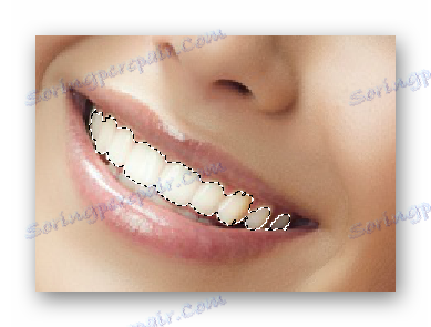 Dentition في Photoshop- على الإنترنت